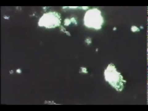 Lyme Disease Bacteria Video Clips! Lyme Disease Bacteria Video Clips!