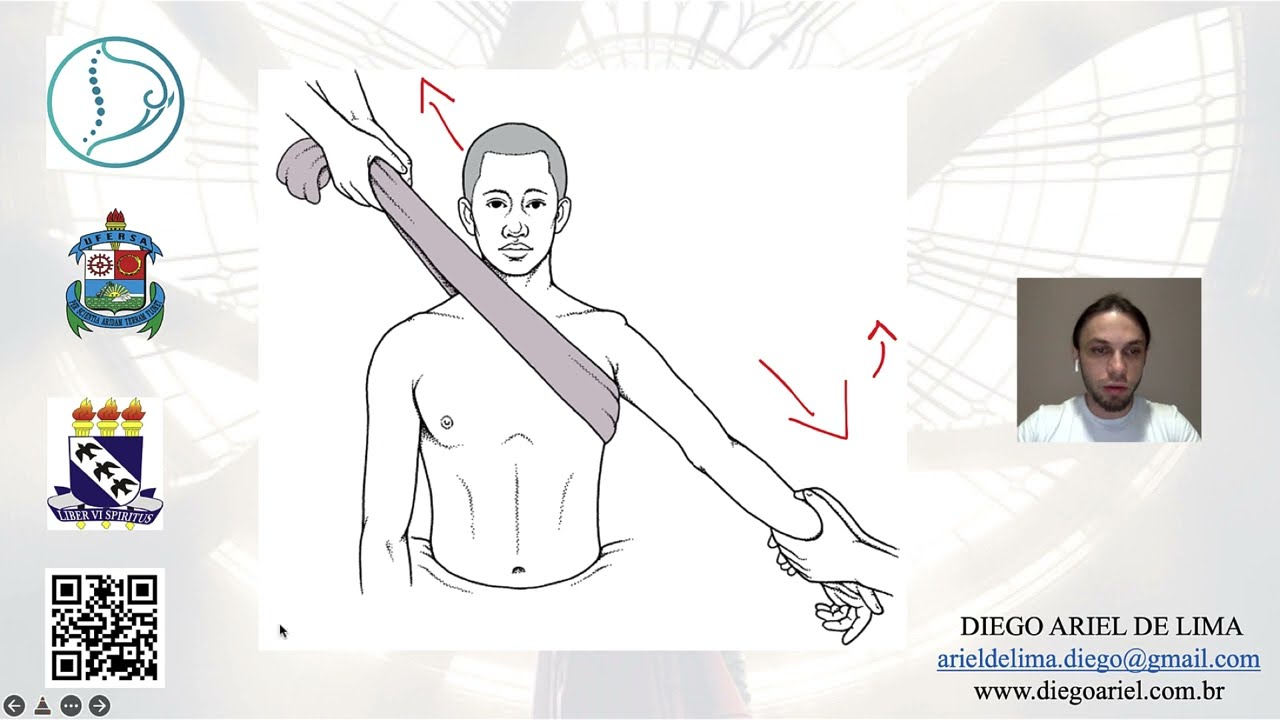 Luxação do Ombro (glenoumeral) - TÉCNICA DE REDUÇÃO [Shoulder Dislocation Reduction Technique]