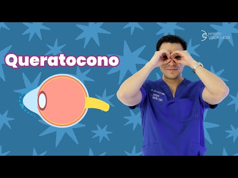 ¿Tengo Queratocono?