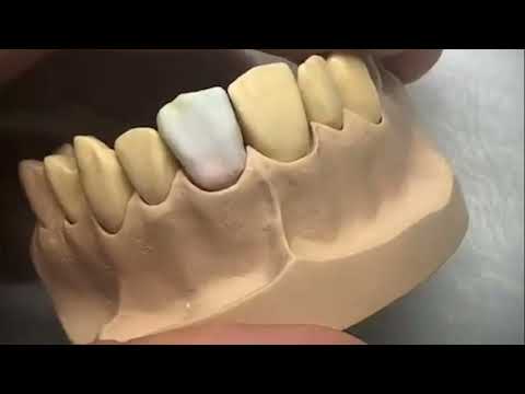 Slide 1 - PINCEL RSPCT #1 (4500-RSPCT-1) (video)