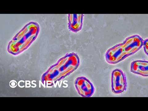 Medical experts on plague risks after reported death of lab worker in Russia