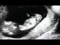 Lindemann-Praise Abort [Official Trailer #1] 