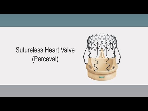 Surgeon Q&A: What is a Sutureless Heart Valve Replacement?