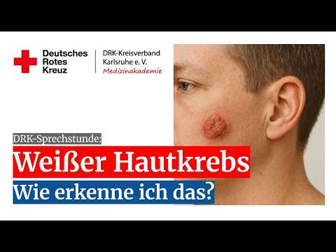 ⚪ WEISSER HAUTKREBS - WIE ERKENNEN? I Dr. med. Dirk Meyer-Rogge I Prof. Dr. med. Bernd-Dieter Gonska