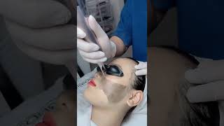 Pico Laser in Poipet