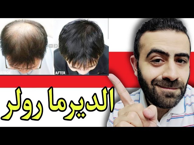ديرما رولر + زيت الكافيين + قلم تحديد اللحية