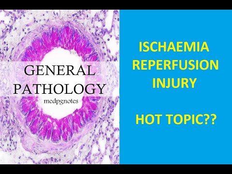 GENERAL PATHOLOGY II CHAPTER 2 II CELL INJURY II ISCHAEMIC REPERFUSION INJURY II ROBBINS  PATHOLOGY