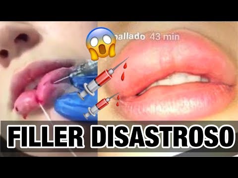 Prendere il sole con pigmentary nota su una faccia Candeggiamo la pelle largilla bianca