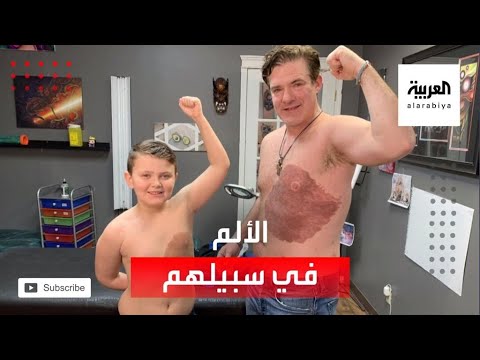  العرب اليوم - شاهد: أب كندي يتحمَّل 30 ساعة من الألم لإسعاد ابنه