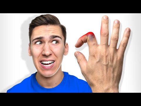 NAJVEĆA BOL NA SVETU! 