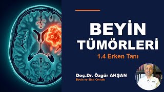 Beyin Tümörleri | 1.5 Beyin Tümörlerinin Nasıl Oluştuğu | Dr Özgür …