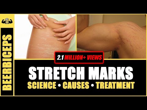 YouTube video about: Can dogs get stretch marks?