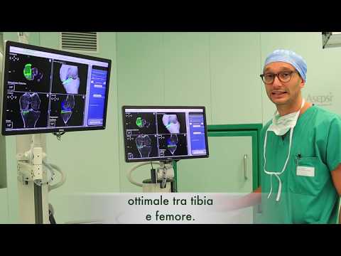 Con push-up click congiunta Un nervo intrappolato nelle iniezioni articolari dellanca