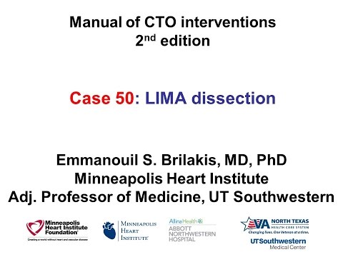 Case 50: Manual of CTO Interventions - LIMA dissection