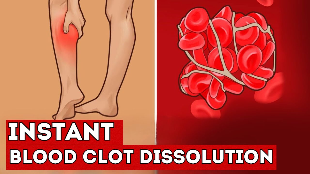 These 7 FOODS Instantly Dissolve Blood Clots in Your Vessels
