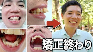 【院内撮影】トルコで歯列矯正終わりました！総額〇〇万円？