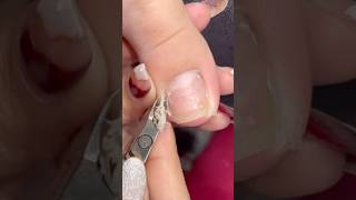 Download lagu Lots of cuticles and dry skin #pedicure #nails #nailcare #satisfying #toenails mp3 Download lagu Lots of cuticles and dry skin #pedicure #nails #nailcare #satisfying #toenails mp3