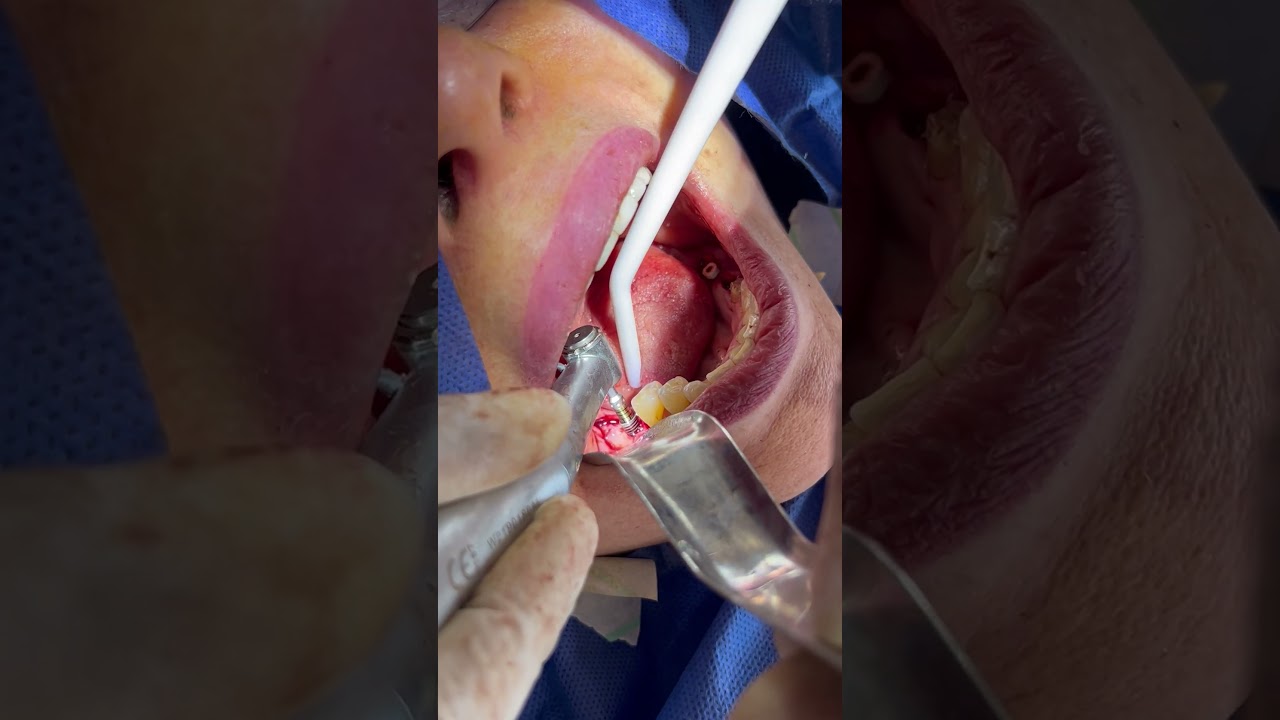 Agustin Salamanca Tapia-28