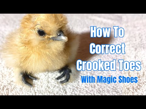 How to correct crooked toes with magic shoes