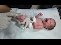 Newborn First NICU Assessment Crying Baby Hungry For Feeding Newborncare Cutebaby Nicucare Baby