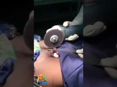 Penis terkecil di dunia Baking soda peningkatan potensi