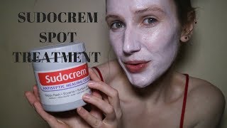 Get rid of spots, acne and blemishes FAST Sudocrem Face Mask