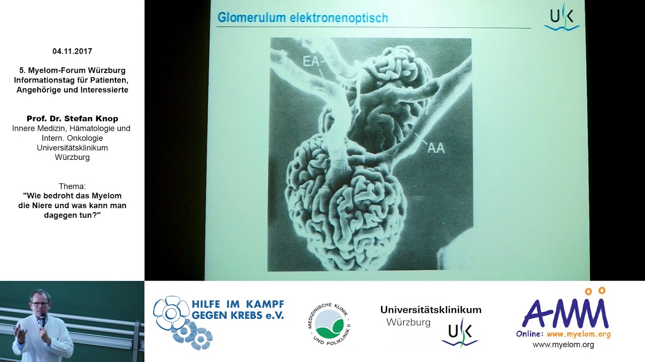 Wie bedroht das Myelom die Niere und was kann man dagegen tun?