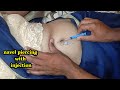 Navel Piercing With Injection For Women Belly Button Piercing Nabhi Piercing