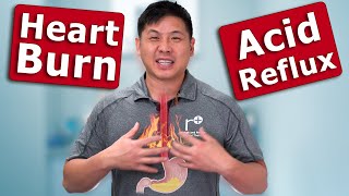 How to Naturally Get Rid of Heartburn Fast