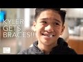 Kyler Finally Gets Braces