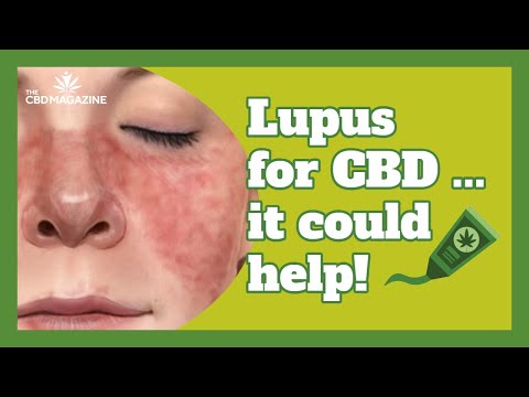 Best recommendation of CBD for arthritis or lupus