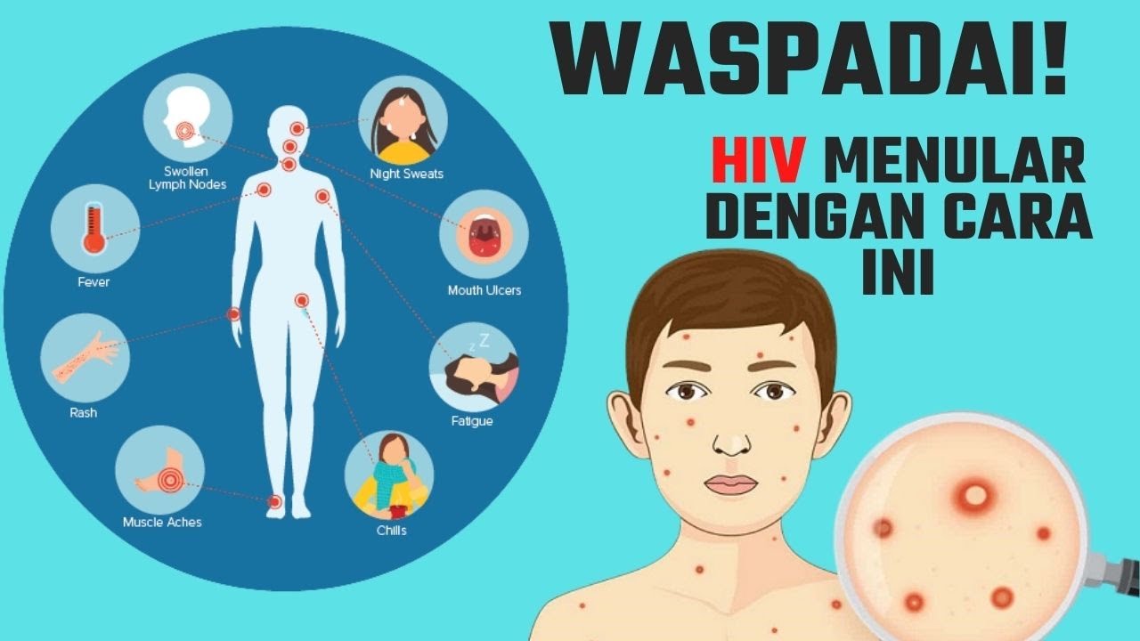Cara Penularan HIV yang Harus Diwaspadai dan Dihindari
