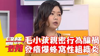 與毛小孩親密共處釀禍！12歲小孩發癢抓到蜂窩性組織炎？！【#醫師好辣】20230103 part3 EP1477 胡逸惟 嚴立婷