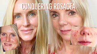 CURE ROSACEA/ACNE T. ROSACEA | How We Treated & CURED our Severe Rosacea (without Antibiotics)