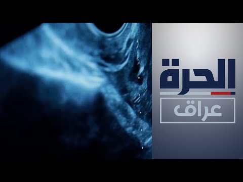 شاهد بالفيديو.. رواج إجراء عمليات اختيار "جنس الجنين" في بغداد والمحافظات