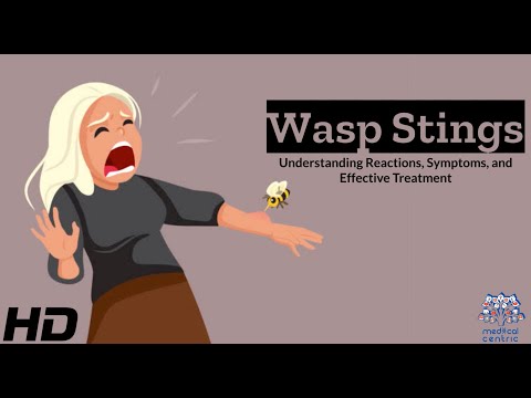 All About Allergy Shots