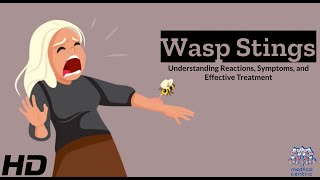 Wasp Stings: Your Ultimate Guide to Reactions and Relief