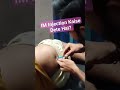 How To Give Intra Muscular Injection In Proper Way Im Injection Kaise Dete Hai Nursing Shorts