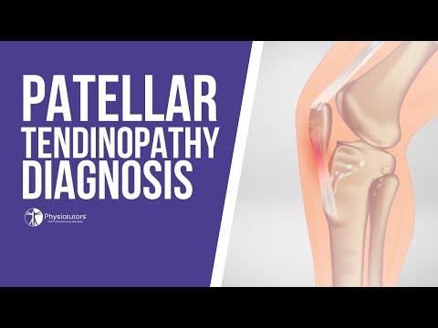 How to Diagnose Patellar Tendinopathy | Jumper's Knee Diagnosis