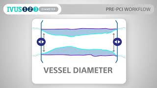 IVUS 123 Essentials: Streamlined Workflows for PCI Imaging Guidance