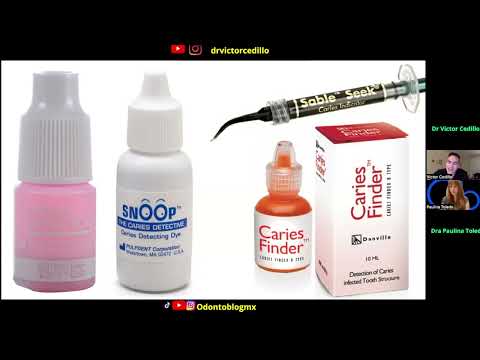 Detector de Caries Dental