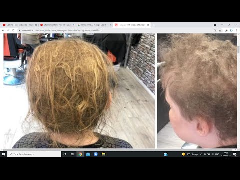 hair phobias, #Trichophobia, #Chaetophobia, #hypotrichophobia, #Tonsurephobia, #Challussetisophobia