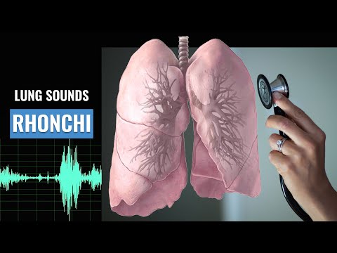 Rhonchi lung sound | Christina NP | Caring Casa