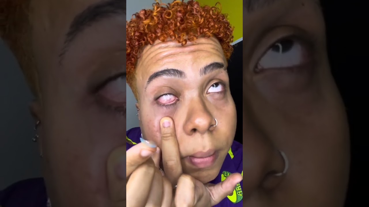 Watch Now quase fiquei cego tentando tirar a lente de contato #shorts quase fiquei cego tentando tirar a lente de contato #shorts