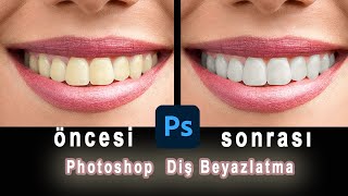 Photoshop DiÅŸ Beyazlatma
