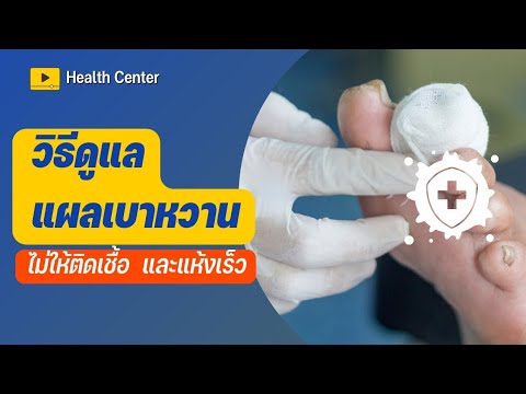 Neurodermatitis โภชนาการที่เหมาะสม จากสิ่งที่ดูเหมือนหนังศีรษะโรคสะเก็ดเงิน