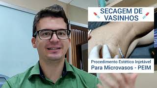 SECAGEM DE VASINHOS - PROCEDIMENTO ESTÉTICO PARA MICROVASOS