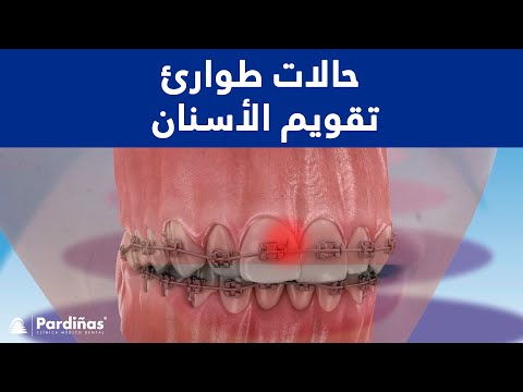 © الهربس الفموي – الأسباب والأعراض