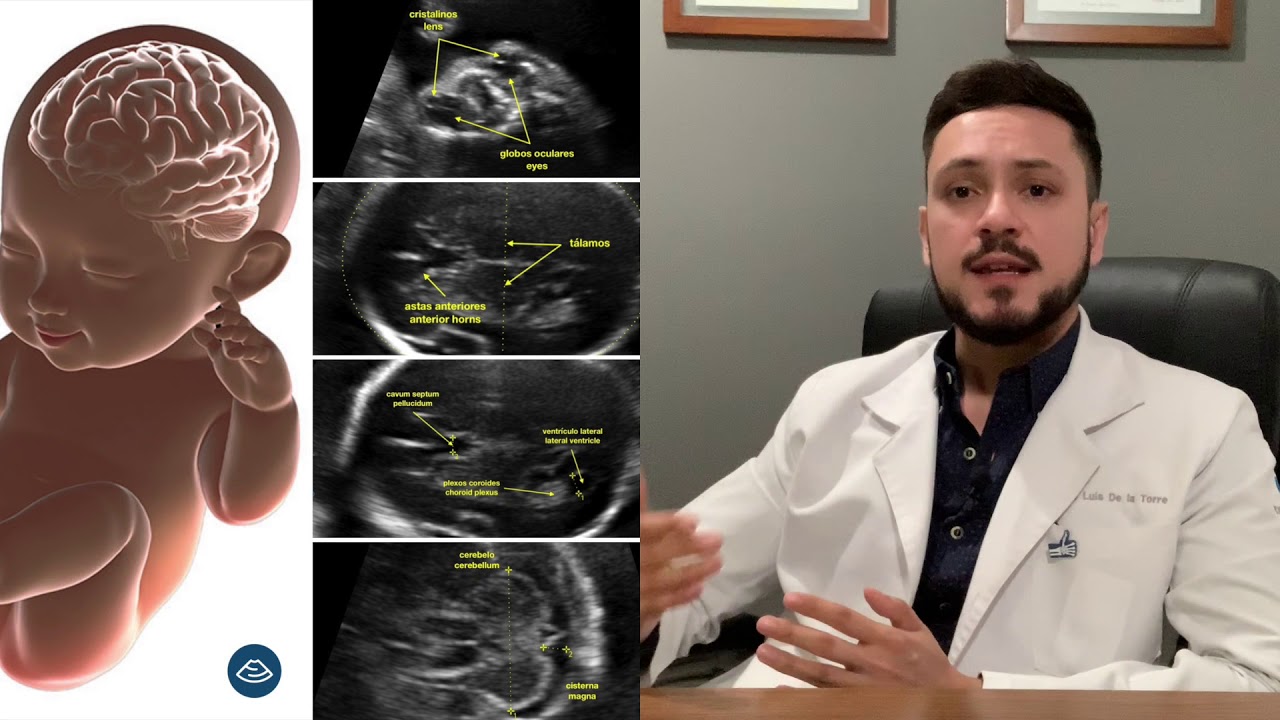 José Luis De La Torre Gastélum-21