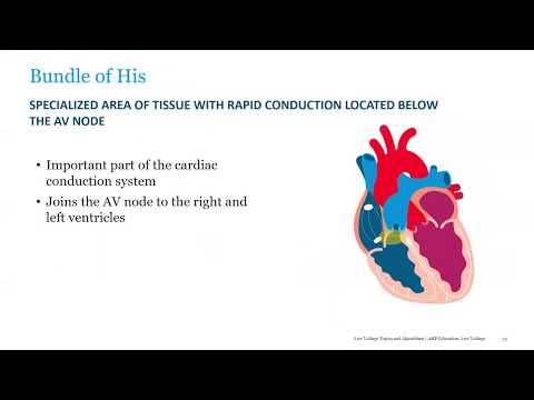 Capture, Sensing, and Impedance: Electrical Concepts of Pacing